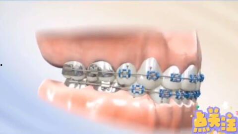 成人蛀牙拔牙全过程视频,揭秘成人拔牙的真实体验