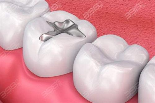 成人补牙事故视频大全集,警惕补牙风险与应对策略