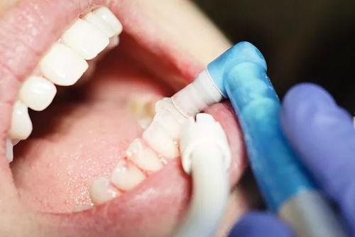 成人补牙事故视频大全集,警惕补牙风险与应对策略